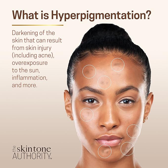 Ambi - Even & Clear | Fade Cream | 2 Variants | Moderate Dark Spots | Stubborn Dark Spots | Hydroquinone - Free | Niacinamide | 1Oz - Beauty Exchange Beauty Supply