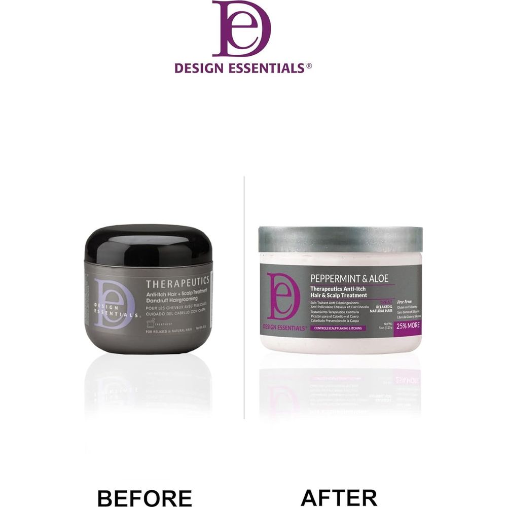 Design Essentials Peppermint & Aloe Therapeutics Anti - Itch Treatment 5 oz – Soothe, Cool & Refresh Dry, Itchy Scalp - Beauty Exchange Beauty Supply
