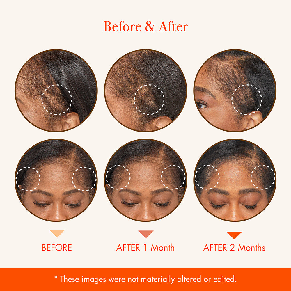 Red by Kiss Growth MD Scalp Treatments