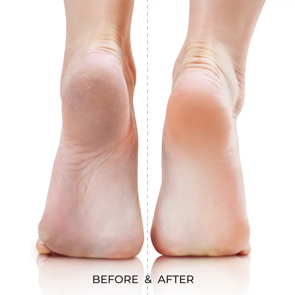 Kiss New York Dual - Sided Foot File – Quickbuff - Beauty Exchange Beauty Supply