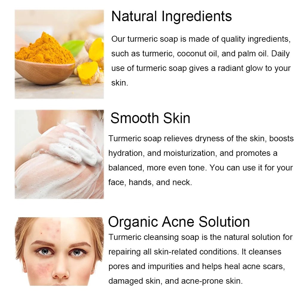 Lanthome - Turmeric Cleansing Soap Bar | Face | Body Soap | Cleanses Skin | Reduces Acne | Refining Pores | Natural Turmeric | Skin Care Soap | All Skin Types | 100g | - Beauty Exchange Beauty Supply