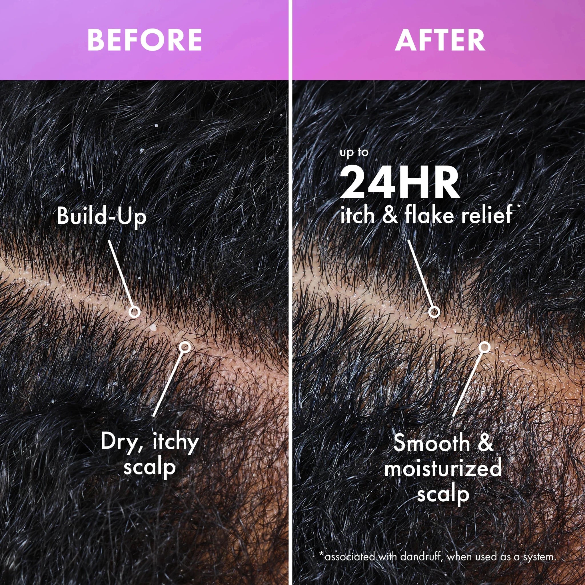 Mielle Lavender & Lychee Scalp Moisturizing – 12oz - Beauty Exchange Beauty Supply