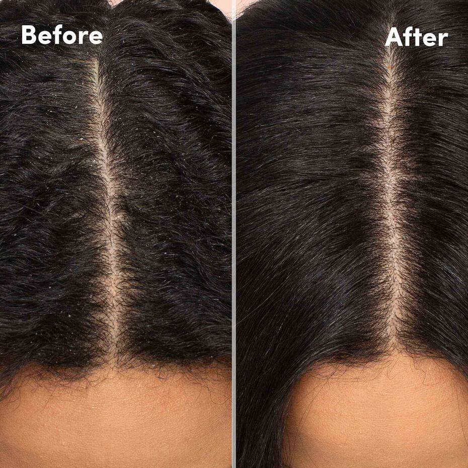 Mizani Scalp Care Hydrating Shampoo โ 16.9oz - Beauty Exchange Beauty Supply