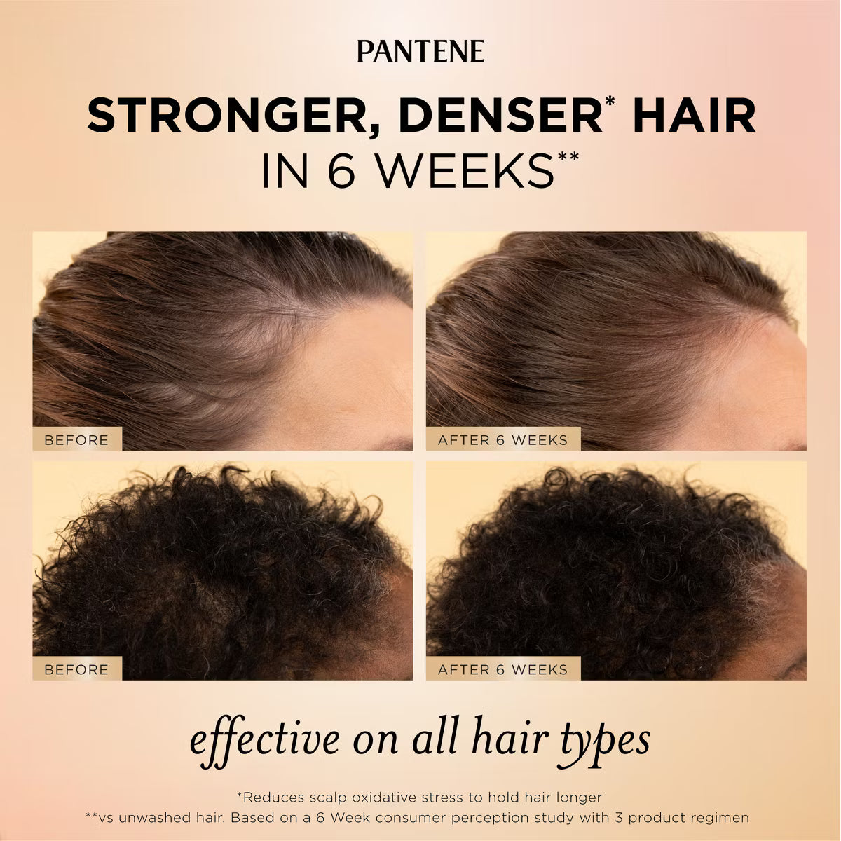 Pantene Pro-V Abundant & Strong Anti-Hair Loss Treatment Serum – 2oz