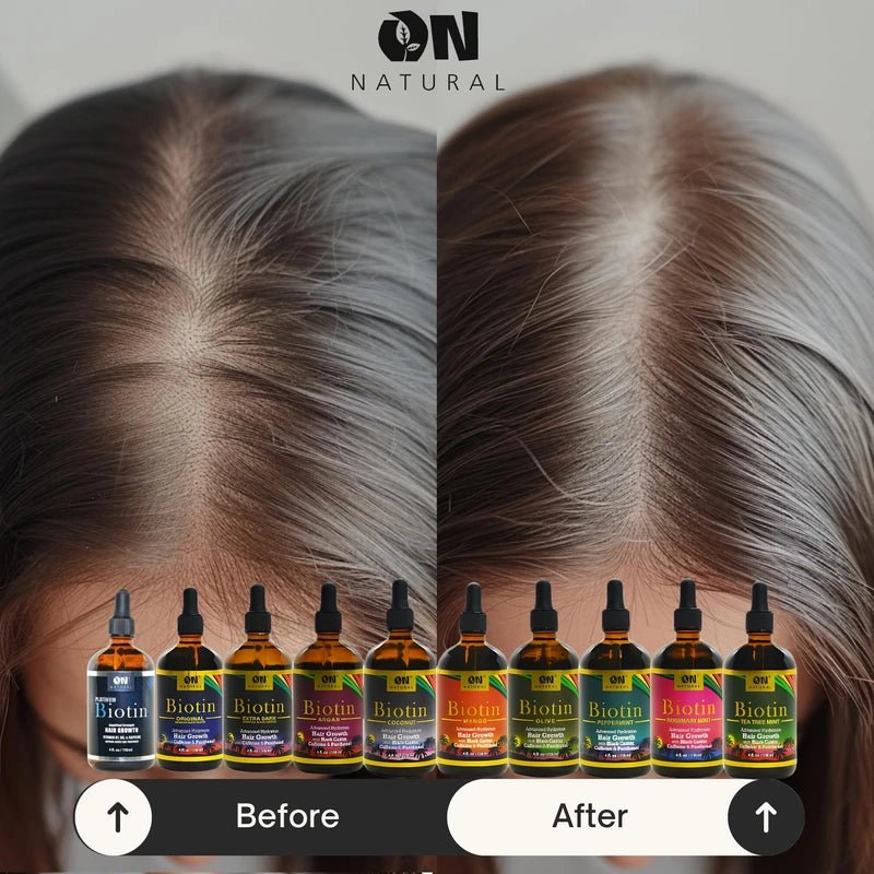 On Naturals Hair & Scalp Oil | Strength, Growth & Repair | 2 Variants – 4 oz - Beauty Exchange Beauty Supply