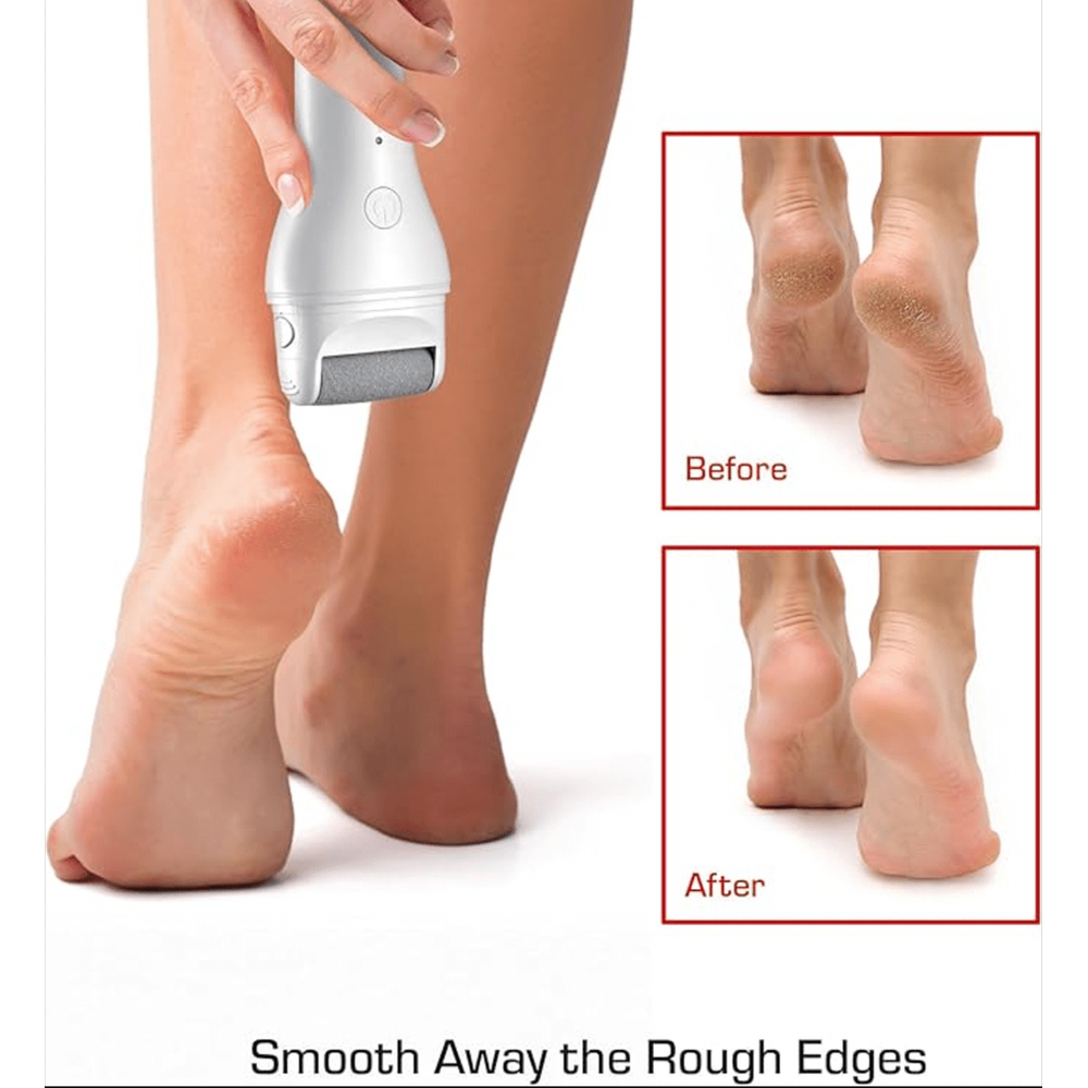 Red by Kiss Cordless Foot Callus Remover – Dual - Speed Pedicure Tool w/ 3 Rollers, Curved Head, Wet & Dry Use, 2 - Hour Runtime - Beauty Exchange Beauty Supply