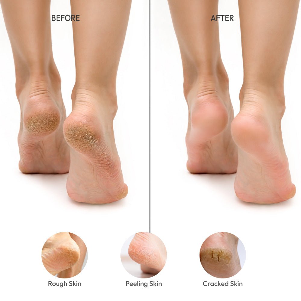 RED BY KISS Pedicure File - Jumbo Size - Ultimate Foot Care for Smooth, Soft Feet - Beauty Exchange Beauty Supply