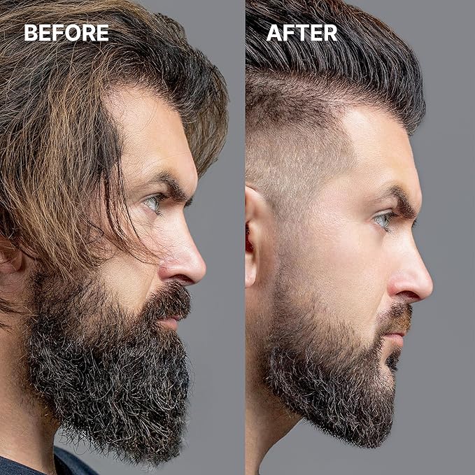 RPM Beard Shear – Gold HS20 - Beauty Exchange Beauty Supply