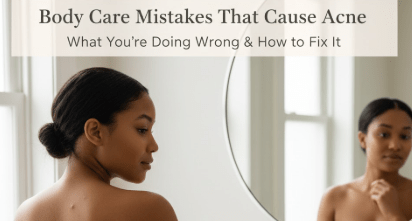 Body Care Mistakes That Cause Acne - Beauty Exchange Beauty Supply