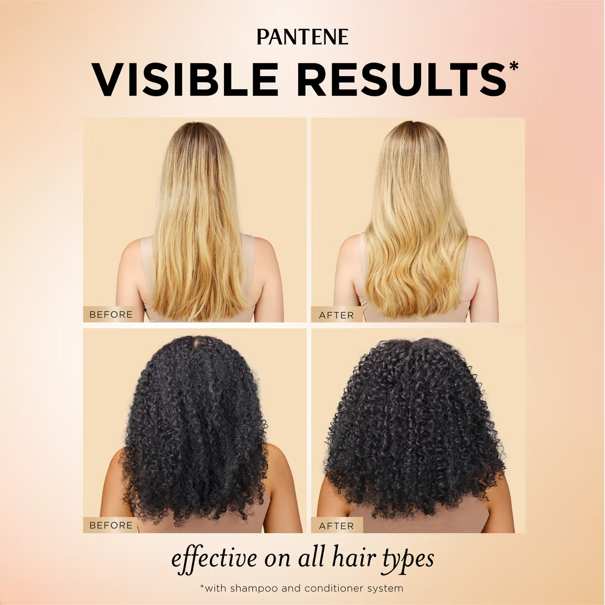 Pantene Pro-V Abundant & Strong Anti-Hair Loss Shampoo – 13.5 oz