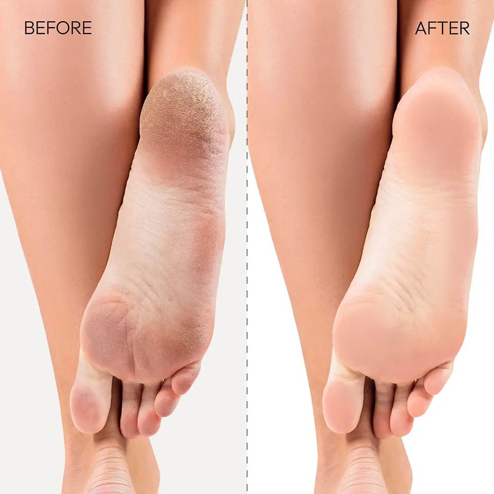 Kiss New York Dual - Sided Foot File - Regular - Beauty Exchange Beauty Supply