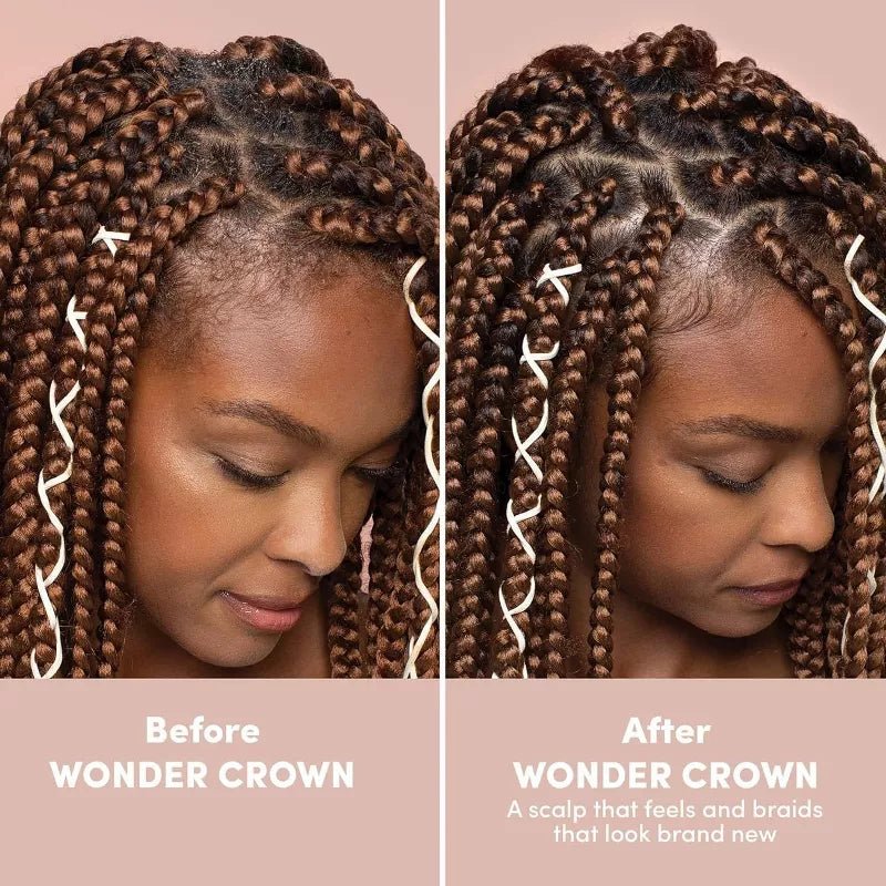 Mizani Wonder Crown Scalp Cleanser | Dry Scalp & Dandruff Treatment | Stimulates Hair Growth | 6.8oz - Beauty Exchange Beauty Supply