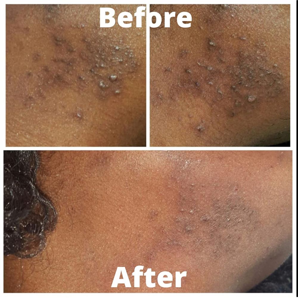 Original Exfoliating Soap – Deep Cleanse 200g - Beauty Exchange Beauty Supply