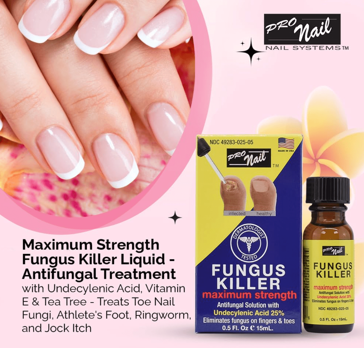 Pro Nail Fungus Killer Antifungal Treatment - 0.5oz - Beauty Exchange Beauty Supply
